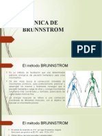 Tecnica de Brunnstrom