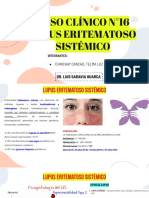 Lupus Eritematoso Sistémico