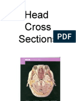 Cross Sections