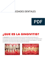 Enfermedades Dentales