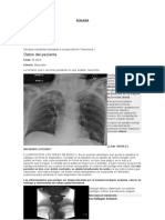 Acalasia Resumen