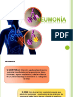 Neumonia de La Comunidad