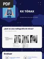 TX Tórax - CIGP