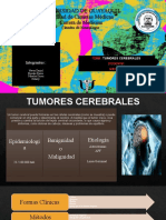 Tumores Cerebrales