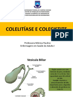 Aula de Colelitíase