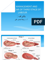 Active Management of Third Stage of Labour