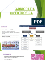 Miocardiopatia Hipertrofica