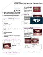 Anterior Resin Infiltration