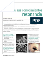 Verifique Sus Conocimientos: Resonancia