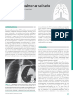 5 - N Dulo Pulmonar Solitario - 2010 - Neumolog A CL Nica