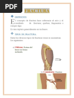 Tarea de Fractura