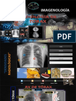 Radiologia y Tomografia de Torax