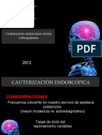 Cauterizacion Endoscopica Esfenopalatina