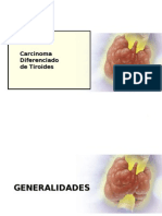 Tema 46 - Carcinoma Diferenciado Tiroides