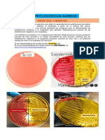 Staphylococcus Aureus