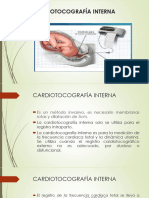 4.-Cardiotocografía Interna