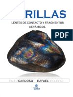 Carillas Lentes de Contacto y Fragmentos Cerámicos.