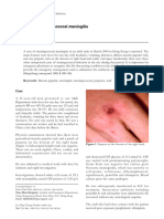 Lee Et Al 2001 Case Report Meningococcal Meningitis