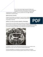 Mixomas Odontogénico