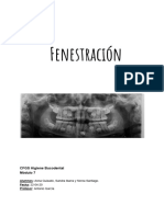 Trabajo FENESTRACIÓN