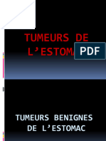 Tumeurs Benignes Et Malignes de L'estomac