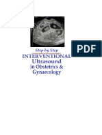 Step by Step Interventional Ultrasound in Obstetrics and Gynaecology