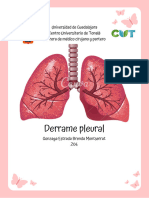 Derrame Pleural