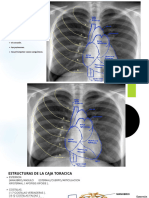 CAJA TORACICA Presentación.
