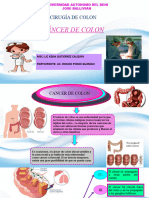 Cancer de Colon