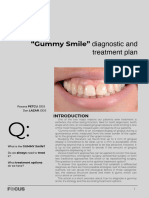 Gummy Smile - Diag and Treatment Plan