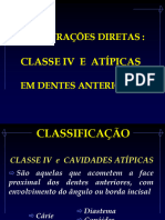 Restaurações Classe IV e Atípicas