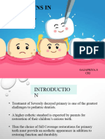 Crowns in Pediatric Dentistry