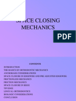 Space Closing Mechanics - DIFFERENT LOOPS