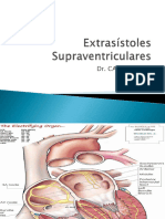 Extrasístoles SUPRA CLASE FINAL