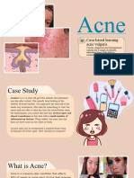 Acne Presentation