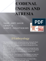 Duodenal Stenosis Kriti Jangir Group 4