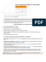 Diferencias Entre El Electrocardiograma Pediátrico y El Del Adulto