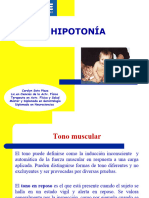 Hipotonía