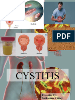 Cystitis