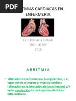 Arritmia Cardiaca