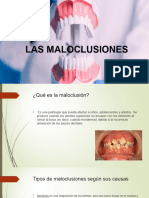 Las Maloclusiones