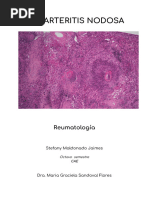 Poliarteritis Nodosa