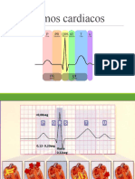 Ritmos Cardiacos