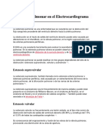 Estenosis Pulmonar en El Electrocardiograma