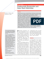 Posttraumatic Boutonniere and Swan Neck Deformities Mckeon2015