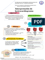 Infografia Ekg