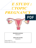 CASE STUDY Ectopic