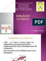 Embarazo Ectópico Listo