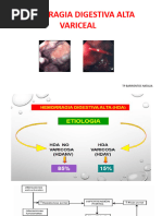 Hda Variceal