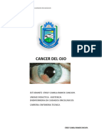 Cancer Del Ojo